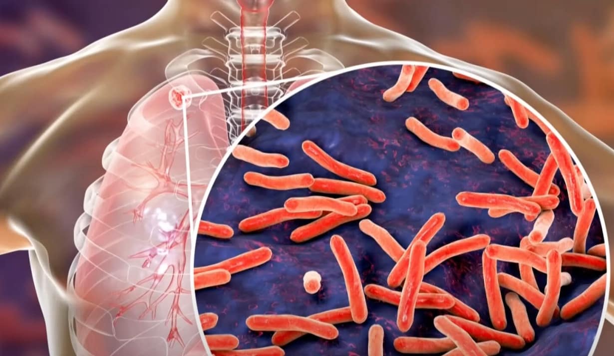 Fear Grows in Maine Over Deadly Disease Cases