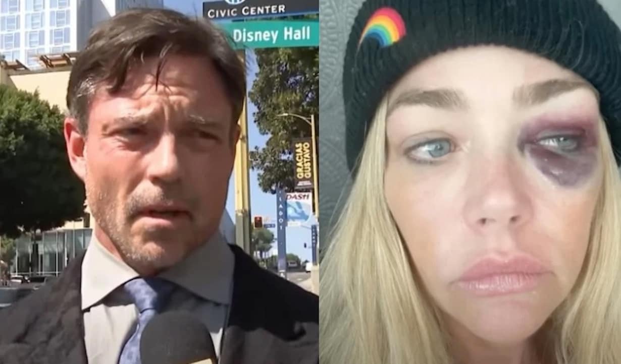 Denise Richards’ Ex Aaron Phypers Breaks Silence on Domestic Violence Claims